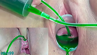 Extreme Gynecological Procedures On Mature Japanese Women